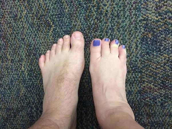 21. "I Was Born With 6 Toes On My Left Foot And My Co-Worker Was Born With 4 Toes On Her Right Foot"