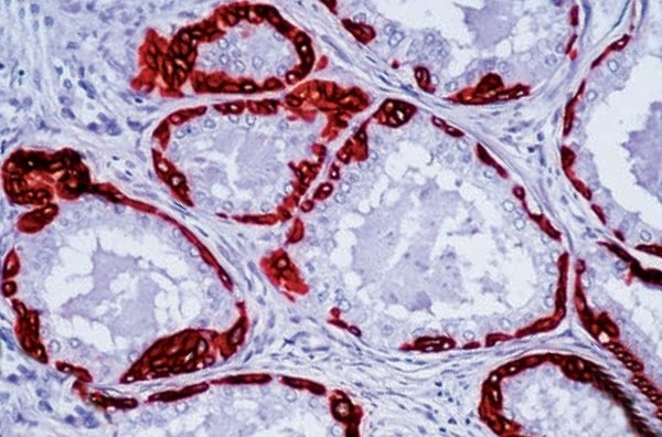 6. Как называется волокнистый белок, из которого состоят волосы и ногти?