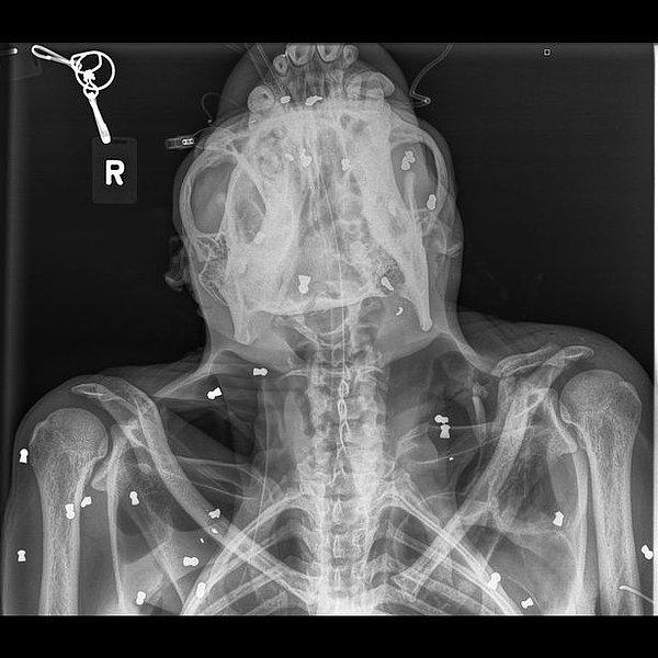 Orangutanın X-ray fotoğrafında vücudundaki mermileri görebilirsiniz: