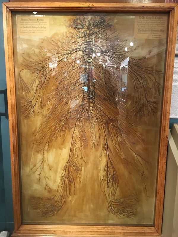 9. Так выглядит полная нервная система человека, которая была извлечена студентами-медиками в 1925 году