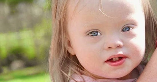 21 Mart Perşembe 21:30 Yarışması İpucu ve Kopya Geldi! Dünya Down Sendromlular Günü Ne Zaman Kutlanır?