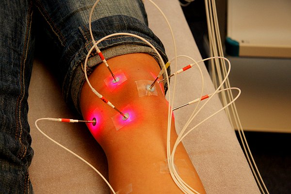 İğeneden korkan kişilere lazer akupunktur uygulanabilir.