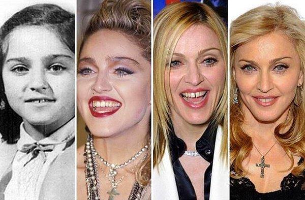 3. Madonna dişlerinin görünümünü yıllar içinde pek çok kez değiştirdi.