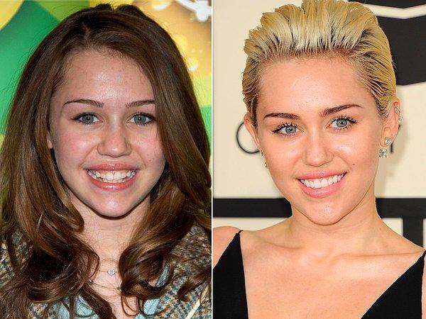 9. Miley Cyrus şu an doğallığını fazla değiştirmediği bir diş yapısına sahip.