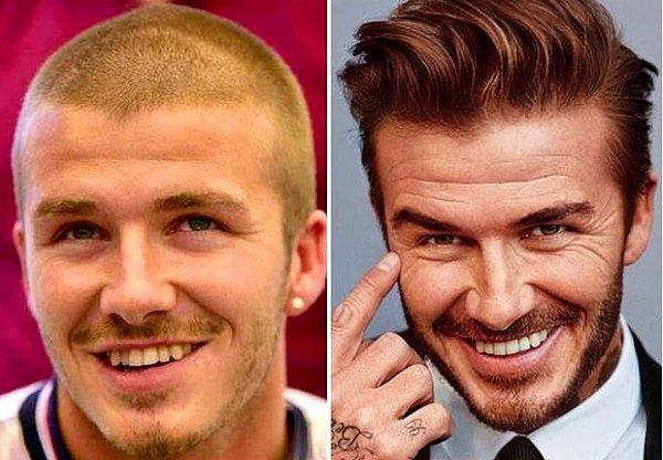 19. David Beckham da eşi gibi yıllar içinde dişlerini yaptırdı.