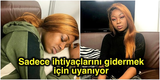 Günde 22 Saat Uyuyor! Milyonda Bir Görülen "Uyuyan Güzel" Sendromuna Yakalanan Kadın