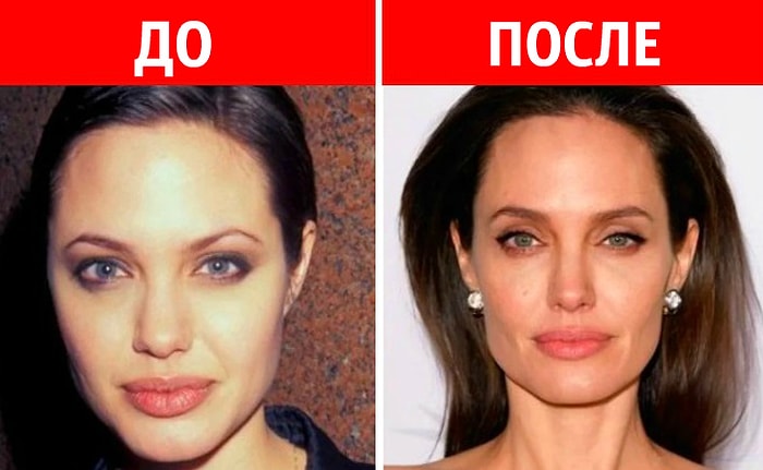 10 звезд, которые отрицают, что делали пластику. Однако их фото говорят об обратном