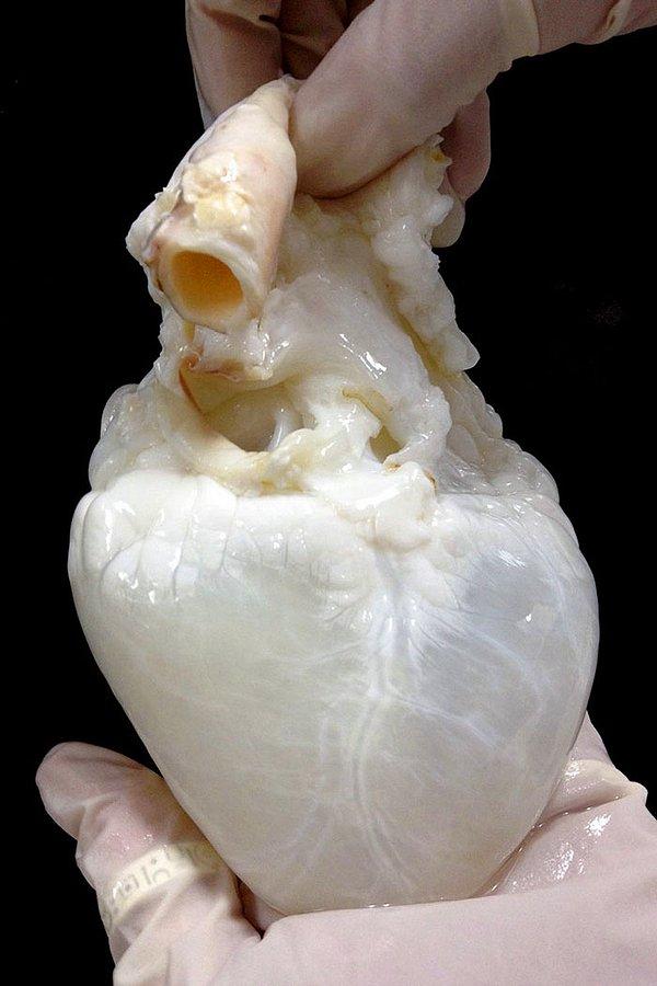 1. Bütün donör hücrelerin temizlenmesinin ardından bir kalp böyle görünüyor.