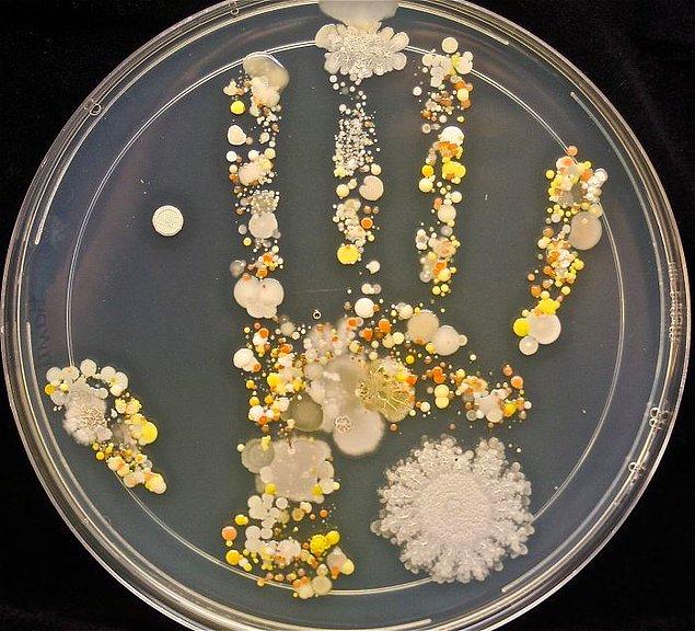 17. Dışarıda oynayan 8 yaşındaki bir çocuğun elinden çıkan mikroplar.