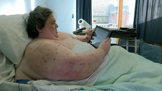 Martin, 2013 yılında Channel 5'ta ''70 Stone & Almost Dead'' programına konuk olmuştu.