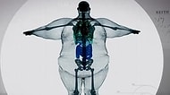 Doktorlar Tarafından 2 Yıl Ömür Biçilen 445 Kilogram Ağırlığındaki Adamın Vücut Röntgeni
