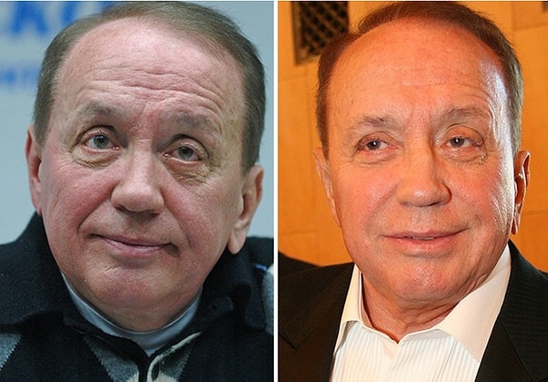 1. Александр Масляков делает ботокс и подтяжки лица