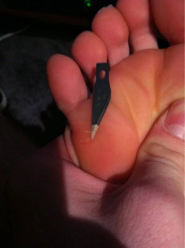 8. Хорошо, что ногу не проткнула