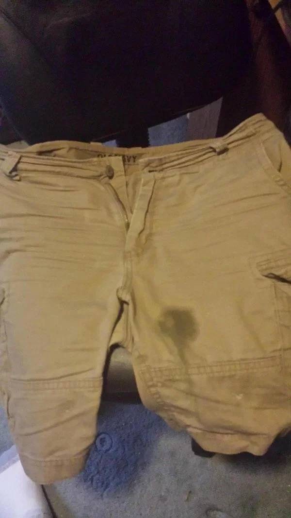 10. "Это след от удара в пейнтболе. Ну вы понимаете, как мне повезло"