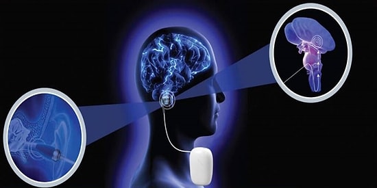 Ağrılara Çözüm Olabilecek 'Migren Kulaklığı' Türk Girişimciler Tarafından Geliştirildi: Vagustim Cihazı