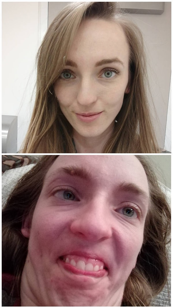 8. Легкий макияж, правильный ракурс, милое выражение лица и - вуаля - ты больше не маленький уродец!