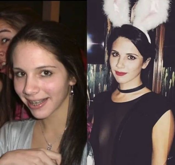 2. Неухоженный прыщавый подросток превращается... в элегантную молодую женщину!