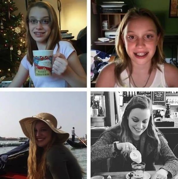 5. Эволюция красоты: минус старомодные очки / минус железные брекеты / плюс роскошные волосы  и уверенность в себе!