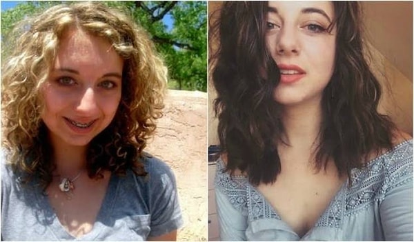 20. В 14 с плохими зубами и нелепым мелированием и в 22 с отличной улыбкой и профессиональным тонированием!