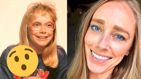 25 людей, которые из очкариков с брекетами превратились в дерзких и стильных красавчиков (прямо как Невилл Долгопупс)