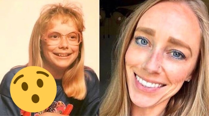 25 людей, которые из очкариков с брекетами превратились в дерзких и стильных красавчиков (прямо как Невилл Долгопупс)