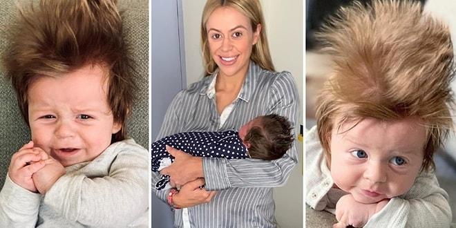Yele Gibi Saçlarıyla Herkesi Şoka Uğratan Instagram Fenomeni, Sevimlilik Abidesi 4 Aylık Bebek