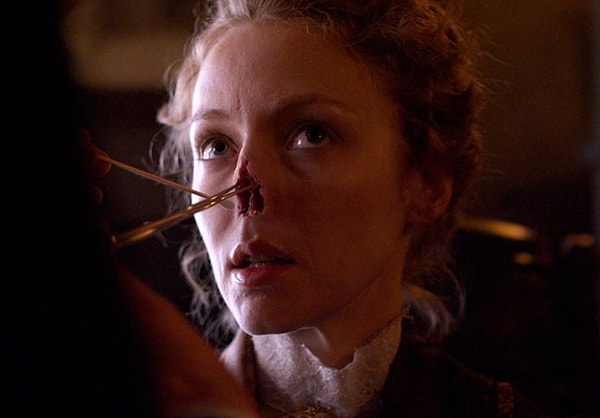 3. Ртуть от сифилиса