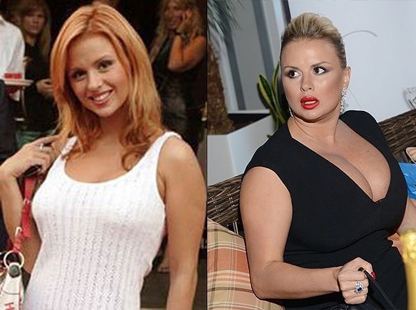 3. Анна Семенович всегда имела пышные формы, но сейчас певица заметно стала больше.