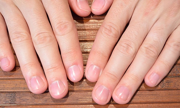 14. Ноготь на среднем пальце растёт быстрее остальных.