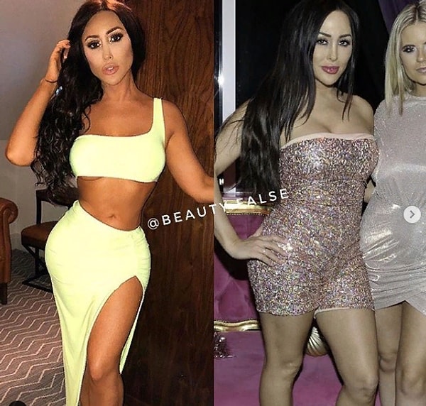 15. Меня одну волнует вопрос: что случилось с ее пупком?