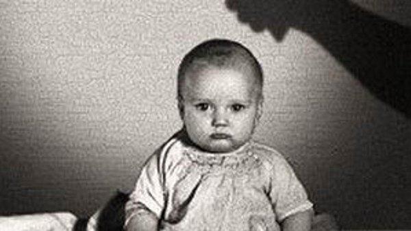 Gerçek adının Douglas Merritte olduğu söylenen bebek Albert ise deney bittikten sonra beyaz ve tüylü nesnelere karşı fobi geliştirip sağlığından olmuştu.