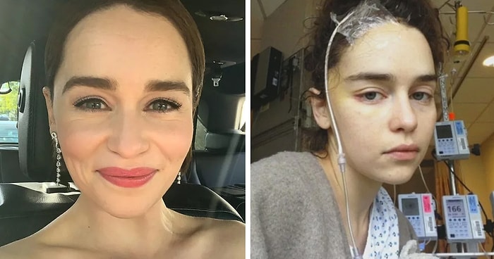 Звезда «Игры престолов» Эмилия Кларк впервые показала фото после инсульта и операций на мозге