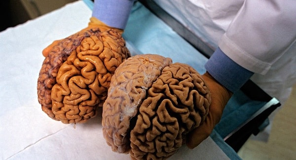 5. А сколько процентов кислорода потребляет человеческий мозг?