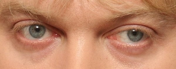 3. Чьи глаза перед вами?