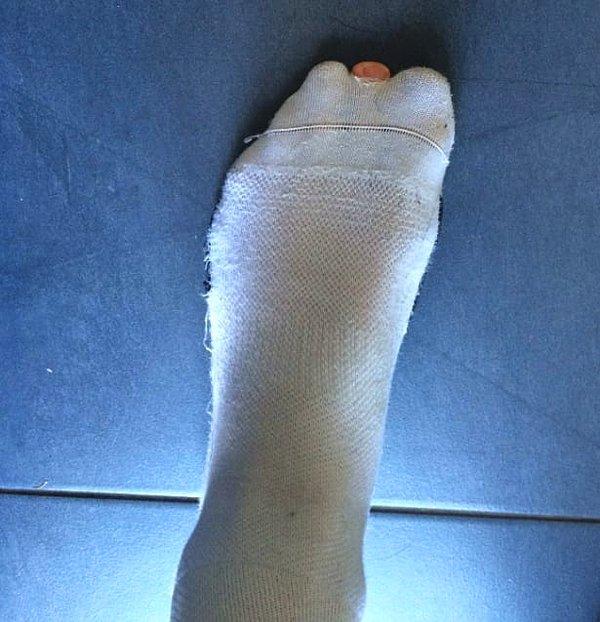13. Çorabın içinde parmağın sana bir merhaba demeye karar verir.