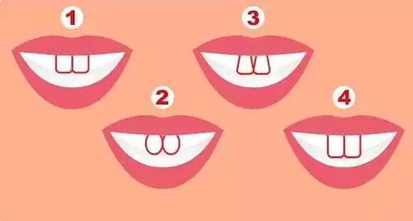 Итак, кликните на ту цифру, под которой указана форма зубов, наиболее похожая на вашу: