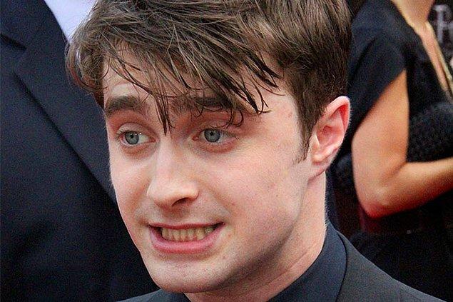 16. Daniel Radcliffe, Sırlar Odası filmi için bacaklarını almıştı.