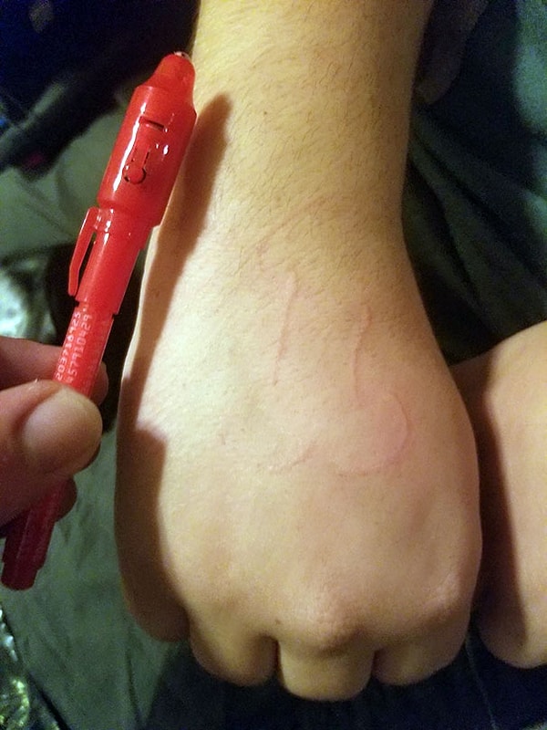 25. «Дети достали где-то «шпионскую ручку», чернила которой можно увидеть только под ультрафиолетовой лампой. У моего брата оказалась аллергия на чернила»