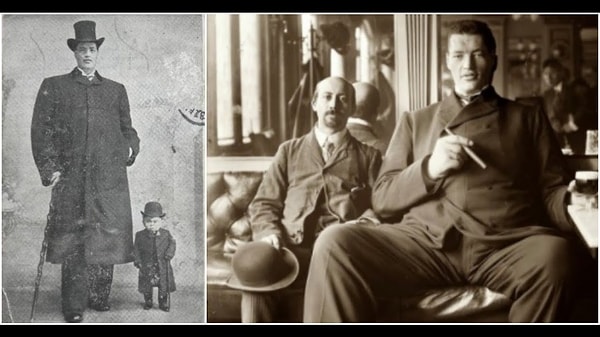 3. Австриец по имени Адам Райнер - единственный человек в истории, которого доктора признали карликом, потом гигантом