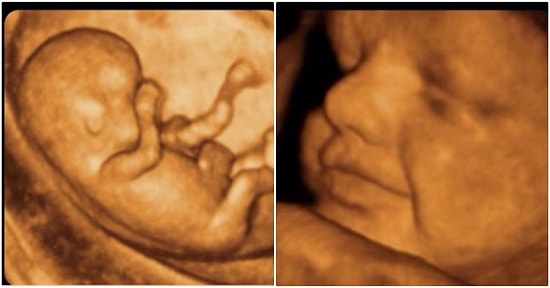 Kırktan Fazla Sayıda Hamile Kadına Aynı Ultrason Görüntüsünü Veren Üçkâğıtçı Doktor