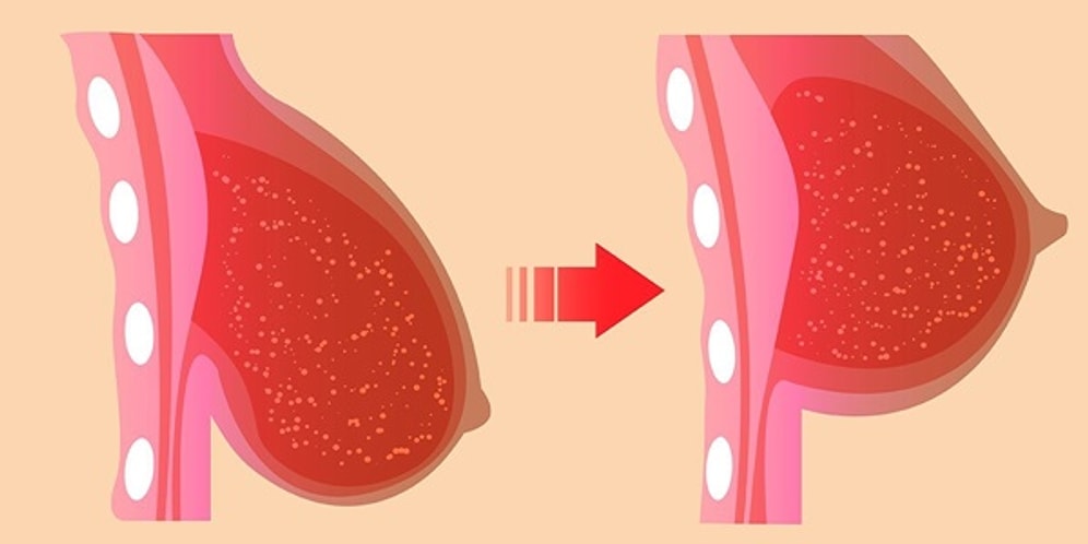 Göğüslerinizi Dikleştirmek İçin Uygulayabileceğiniz Temel Yoga Pozisyonları