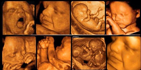 Jinekolog, bebek bekleyen onlarca kadına aynı 3D tarama görüntülerini verdiğini kabul etti.