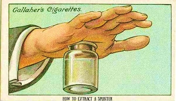 8. Говорят, если наполнить баночку с широким горлом горячей водой, то можно избавиться от занозы.