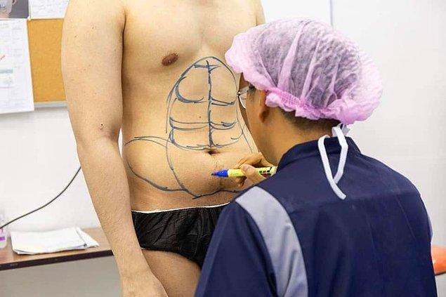 Bangkok'ta bulunan Masterpiece Hospital, erkekler için six pack ameliyatları yapıyor.