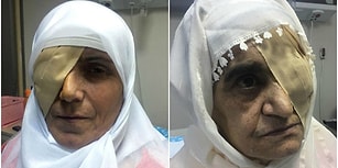Kör Eden Katarakt Ameliyatları Sonrası Üç Kadın, Sağlık Bakanlığı'na 570 Bin TL'lik Dava Açtı