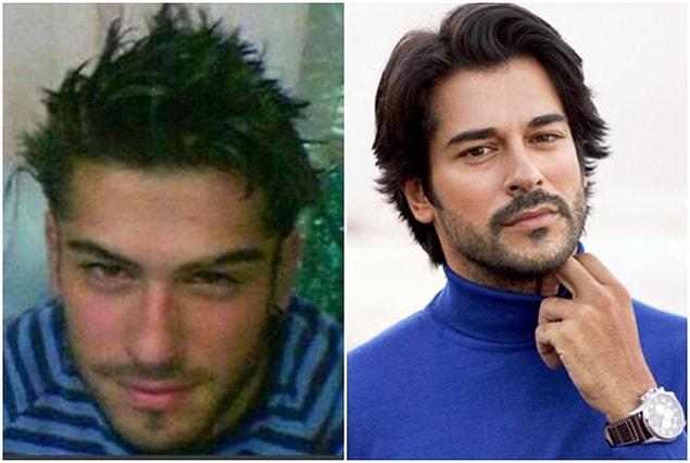 8. Burak Özçivit