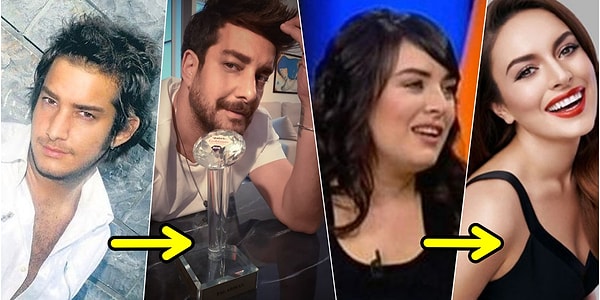 Yillar Icinde Yasadiklari Degisimle Adeta Kucuk Dilinizi Yutmaniza Neden Olacak 18 Unlu Onedio Com