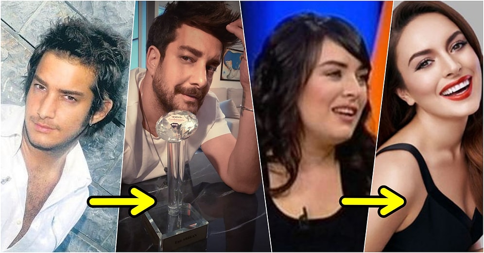 Yıllar İçinde Yaşadıkları Değişimle Adeta Küçük Dilinizi Yutmanıza Neden Olacak 18 Ünlü
