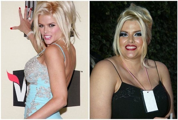 11. Модель "Playboy" Анна Николь Смит умерла 12 лет назад, а до этого поражала всех своим крайне нестабильным весом.