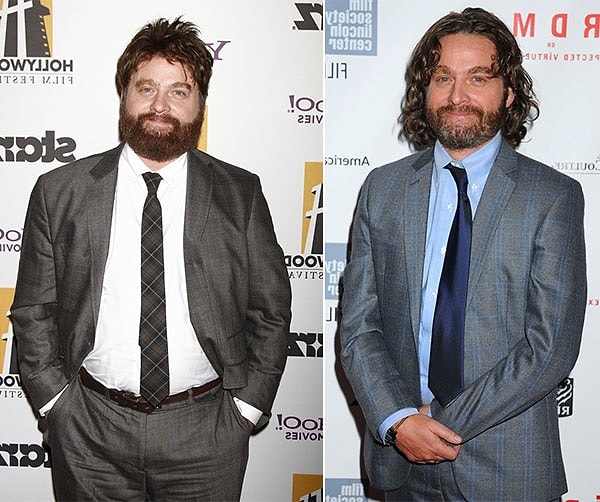 5. Зак Галифианакис отказался от жирка ради серьезных ролей.